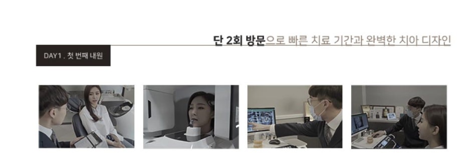 라미네이트 치료 전 체크해야할 부분은? 관련 이미지 10