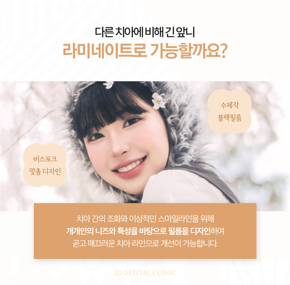 토끼이빨라미네이트 앞니성형으로 단정하고 우아하게 관련 이미지 4