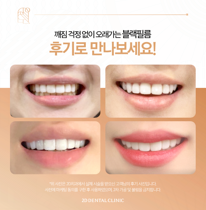 강남라미네이트 얇아도 깨짐 걱정 없는 무삭제 블랙필름 관련 이미지 6