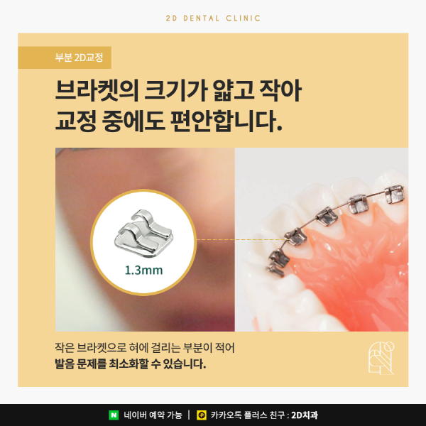 필요한 부분만 부담 없이 빠르게! <부분 2D교정> 관련 이미지 4