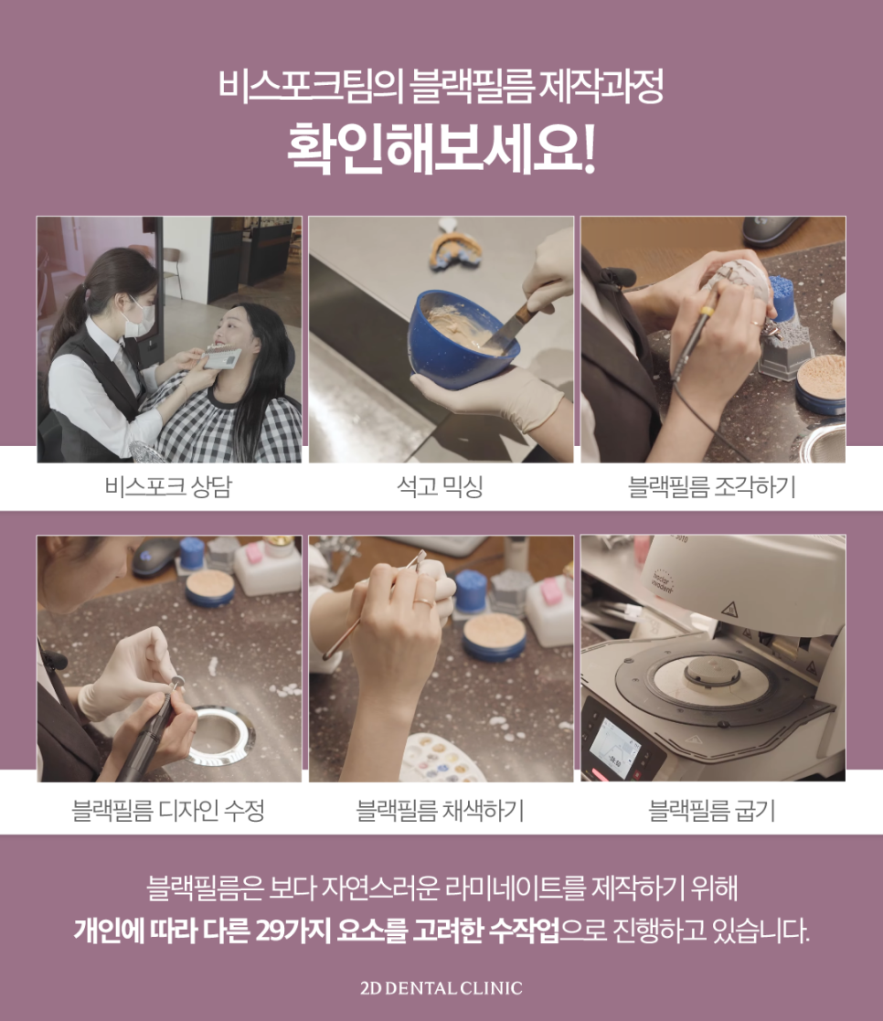 무삭제라미네이트비용 앞니살짝깨짐 더욱 큰 손상을 막기 위해서 관련 이미지 7