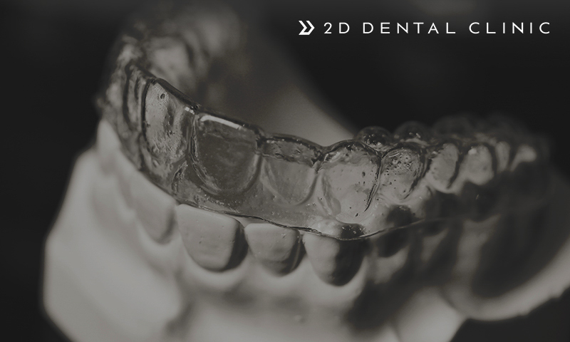 투명교정 비용, 꼼꼼하게 따져보자! 강남 2D치과 관련 이미지 3