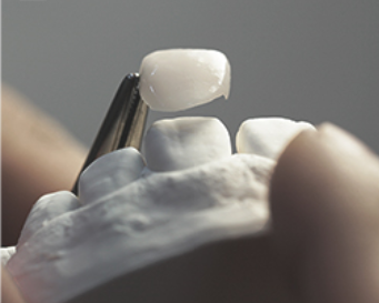 라미네이트 치료 전 체크해야할 부분은? 관련 이미지 9