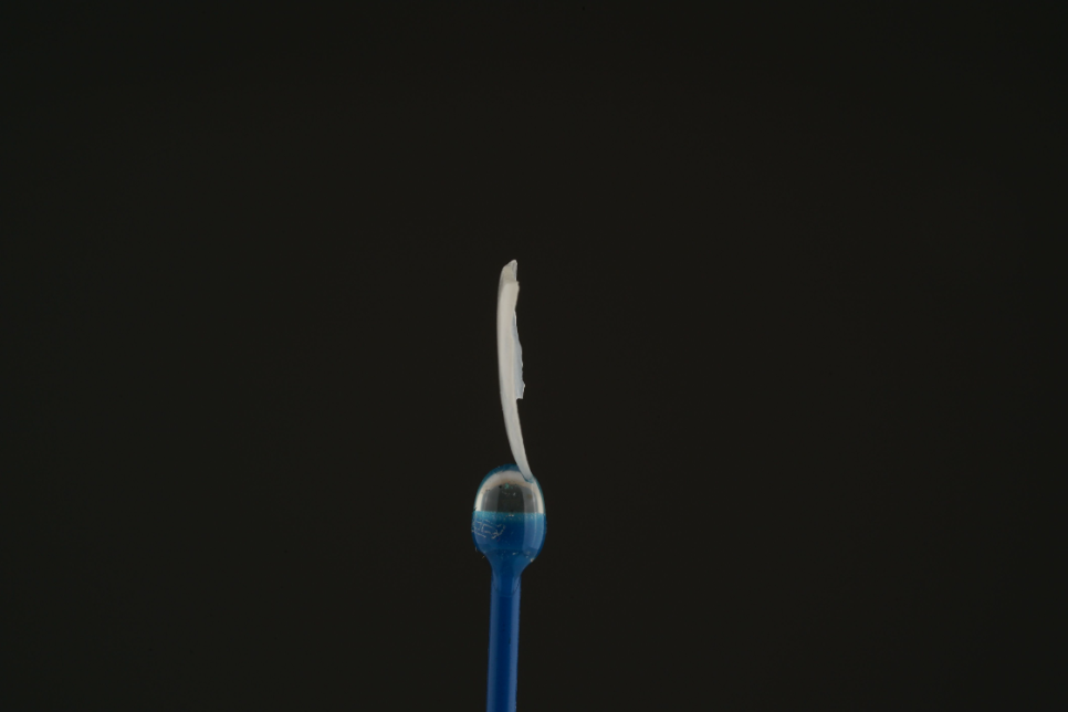 라미네이트치과 알아본다면? 관련 이미지 13