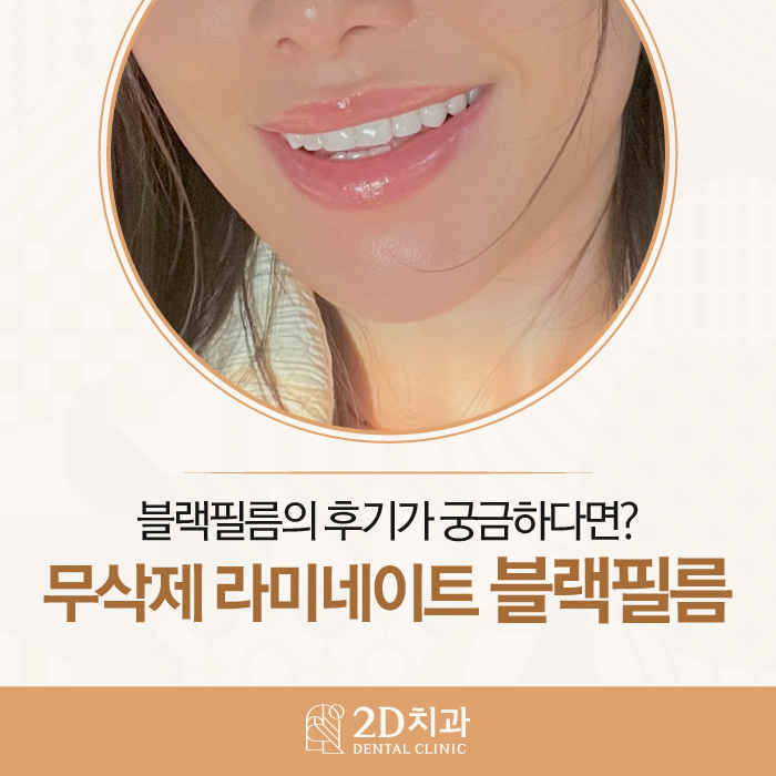 무삭제라미네이트 후기 꼼꼼하게 확인하자! 관련 이미지 1