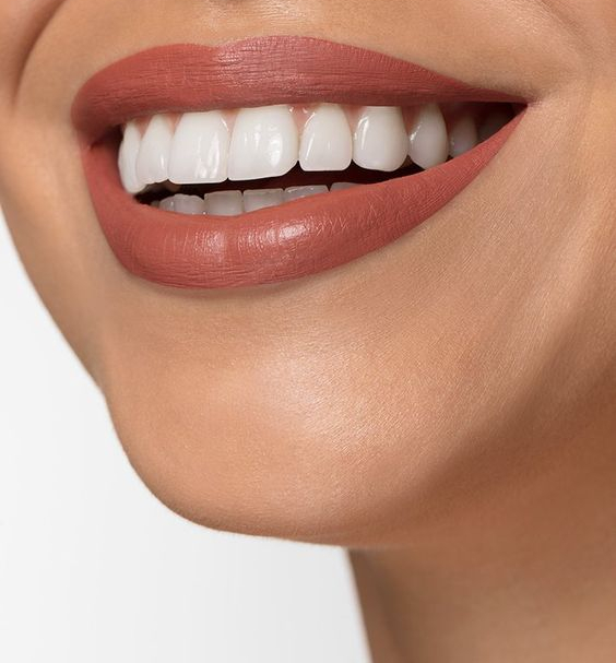 치아삭제 없는 블랙필름 무삭제라미네이트가격 관련 이미지 2