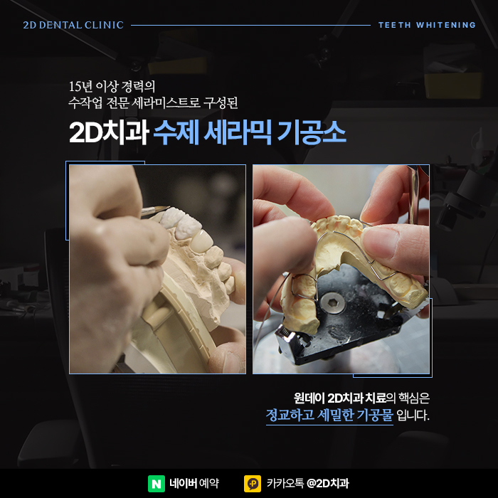 셀프치아미백의 단점, 전문가 치아미백으로 해결 위해서는 강남역 치과 관련 이미지 7
