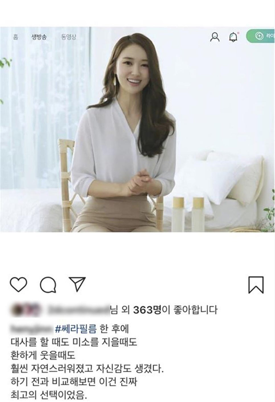 투디치과(2D치과)에서 직!접! 무삭제 쎄라필름을 한 리얼후기 관련 이미지 13