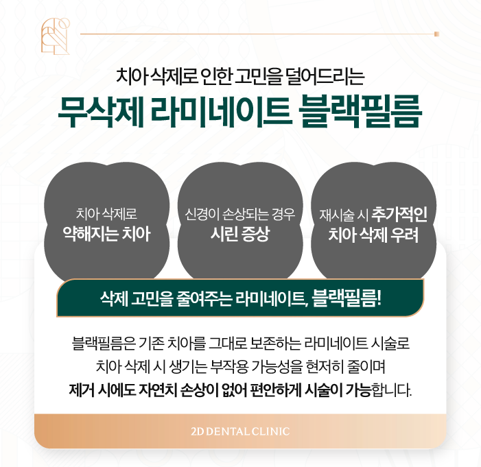 치아 삭제 없는 블랙필름 무삭제라미네이트후기 관련 이미지 6