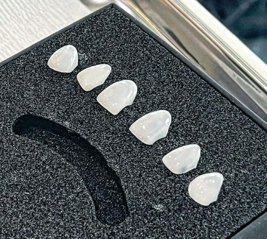 무삭제라미네이트 가격 비스포크 고객 맞춤 라미네이트 블랙필름 관련 이미지 7