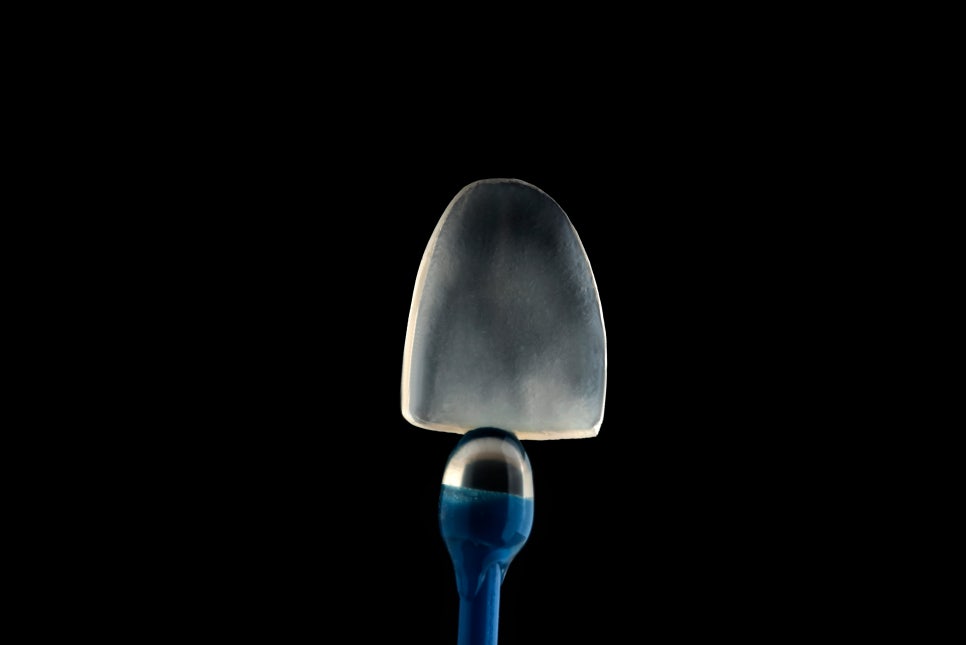 앞니깨짐, 치아미백엔 무삭제 "쎄라필름(TheraFilm)" 관련 이미지 2