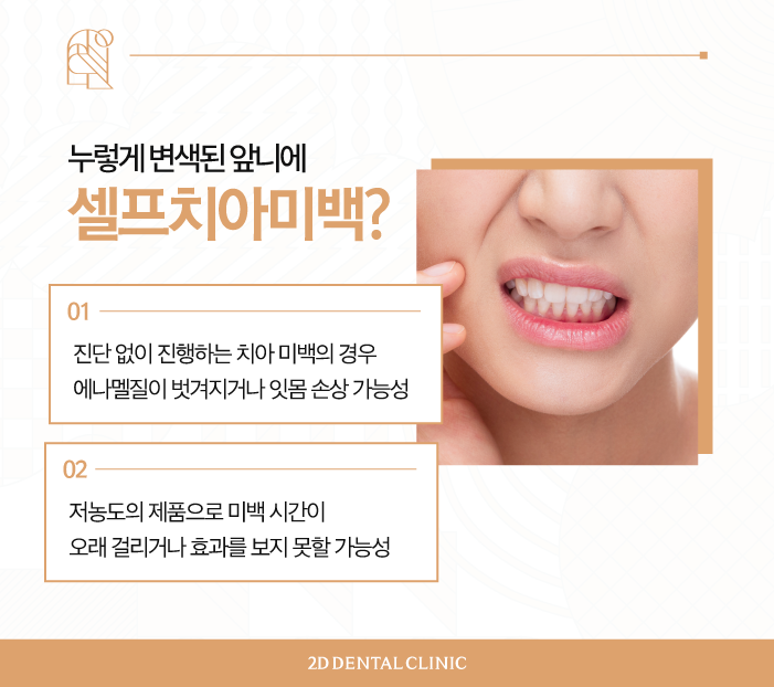 무삭제라미네이트가격 자신감 있게 활짝 웃는 방법 관련 이미지 4