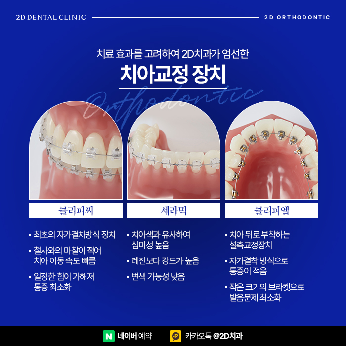 치아교정 비용 차이가 많이 나는 이유는? 신논현 교정치과 관련 이미지 7
