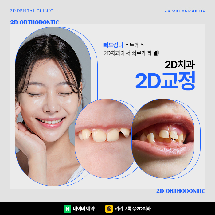 뻐드렁니 고민이라면 강남역 앞니부분교정 잘하는 치과 관련 이미지 1