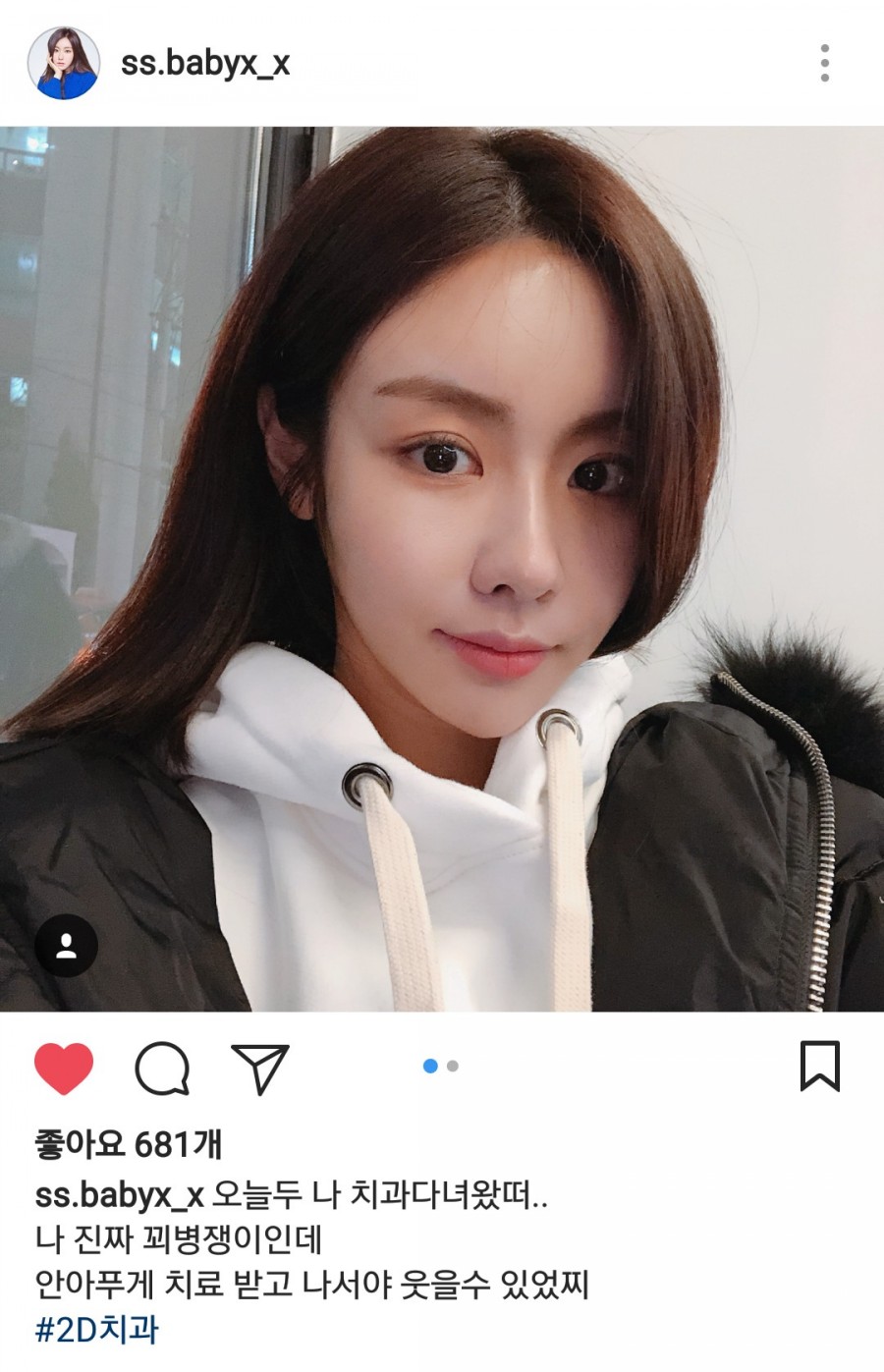 배우 서혜진님 :: 강남역 투디치과 관련 이미지 3