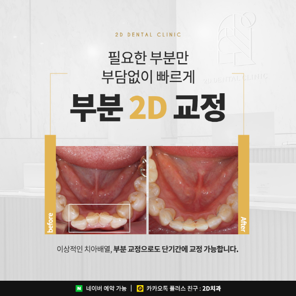 필요한 부분만 부담 없이 빠르게! <부분 2D교정> 관련 이미지 1