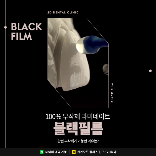 100% 무삭제 라미네이트 <블랙필름>이 가능한 이유는? 관련 이미지 1