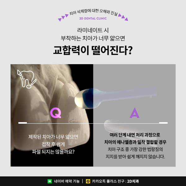 "다시 복구 못해요" 앞니라미네이트 치아 삭제량이 중요한 이유 관련 이미지 4