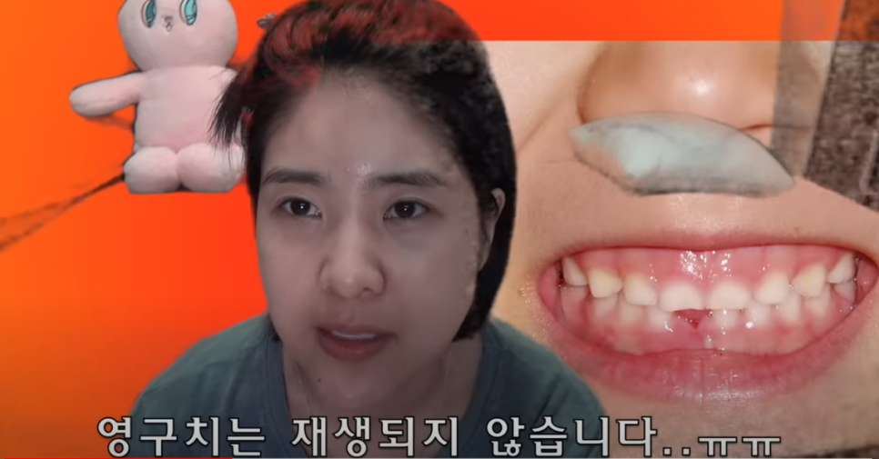 무삭제라미네이트 오해의 진실 관련 이미지 5