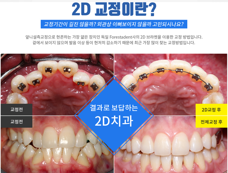 치아교정비용 부담없는 2D치과 관련 이미지 1