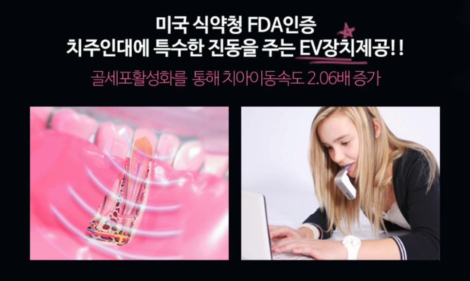 교정기간을 단축시켜주는 엑셀덴트! 강남 투디치과 관련 이미지 6