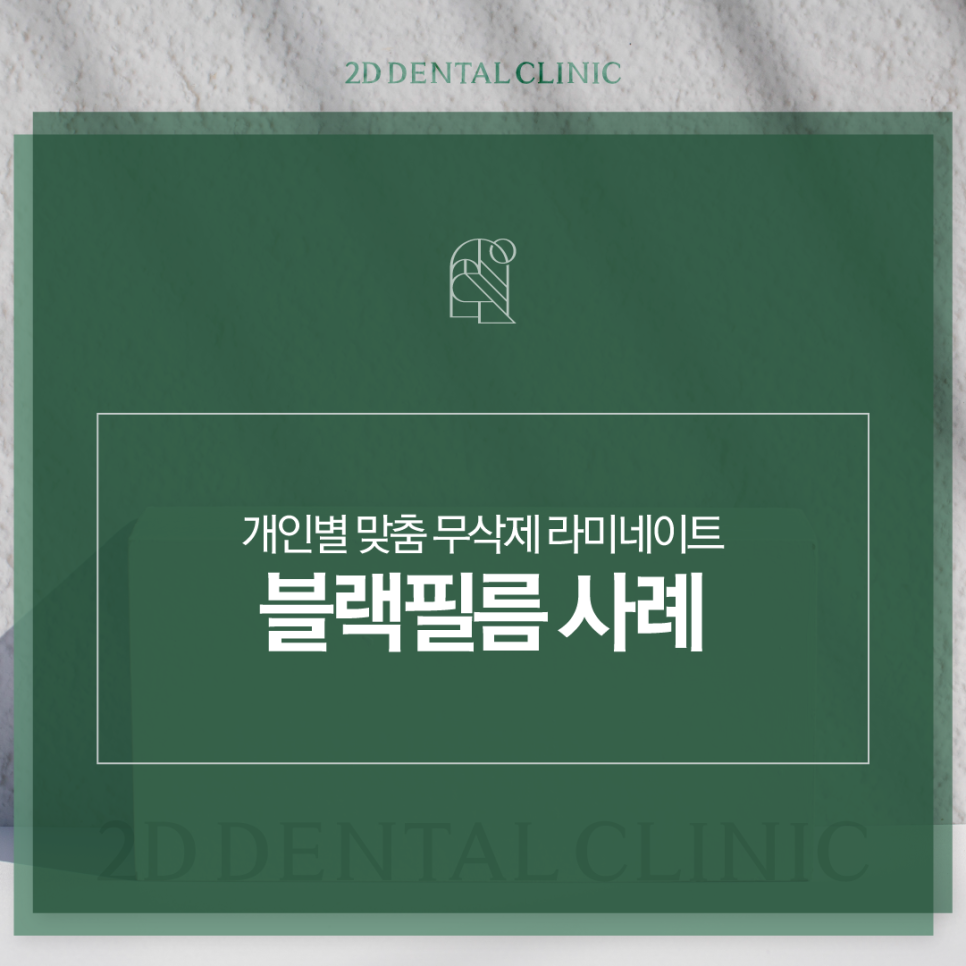 라미네이트하는이유 앞니심미치료 더욱 아름다운 치아로! 관련 이미지 1