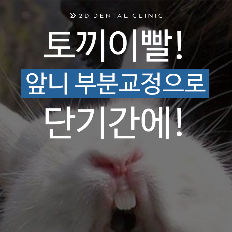 토끼이빨, 앞니 부분교정으로 단기간에! 강남 투디치과 관련 이미지 2