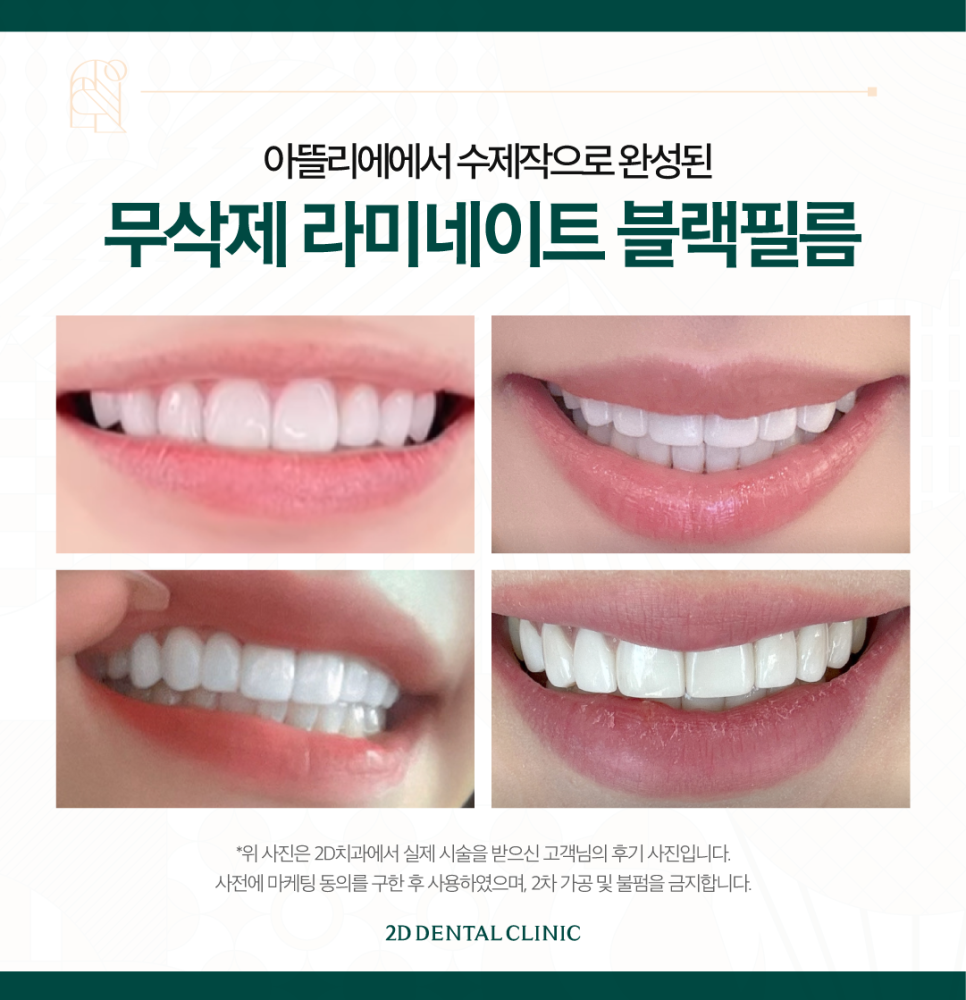 라미네이트무삭제 블랙필름 제작 투디 아뜰리에를 소개합니다! 관련 이미지 8