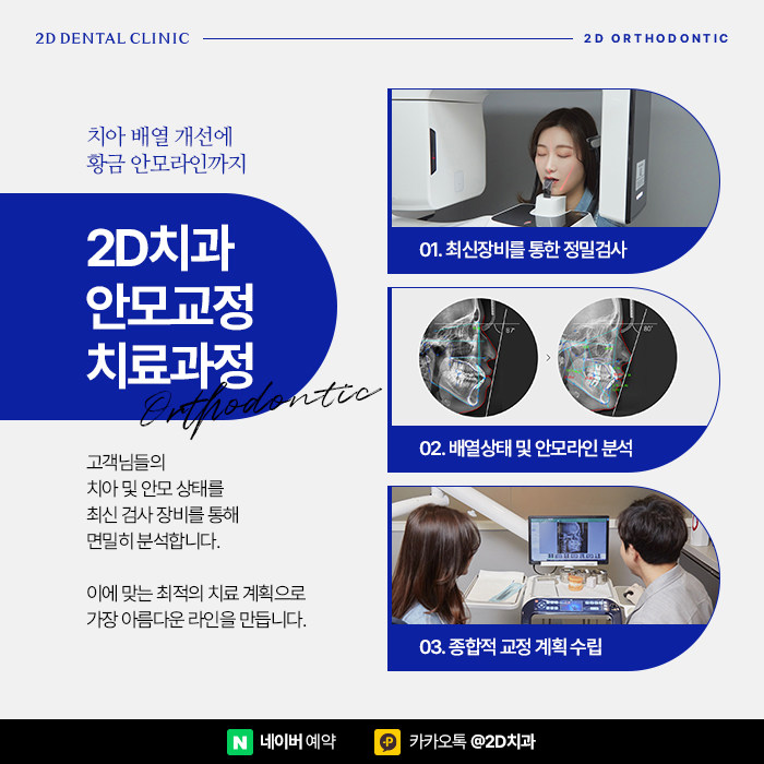 치아교정 비용 차이가 많이 나는 이유는? 신논현 교정치과 관련 이미지 6