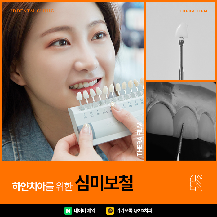 하얀치아로 면접 1분 자기소개 예시 임팩트 준비, 신논현 심미보철 관련 이미지 1