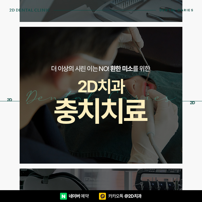 충치통증? 2D치과의 충치치료로 역삼동치과 관련 이미지 1