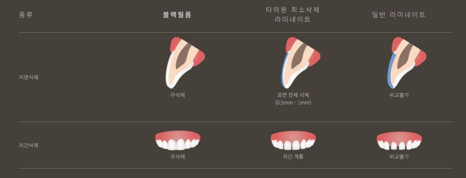 라미네이트가 고민된다면 참고하세요 관련 이미지 1