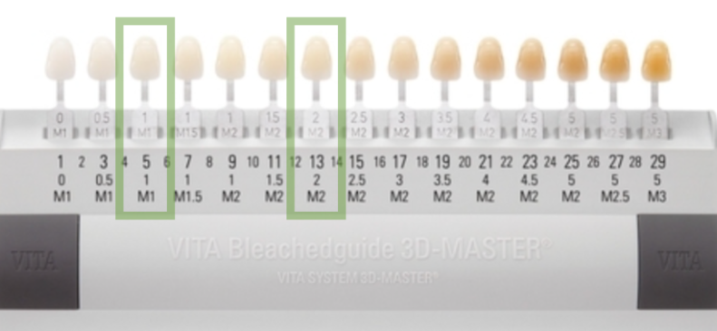 강남라미네이트 앞니변색 치아콤플렉스 개선은 블랙필름 관련 이미지 3