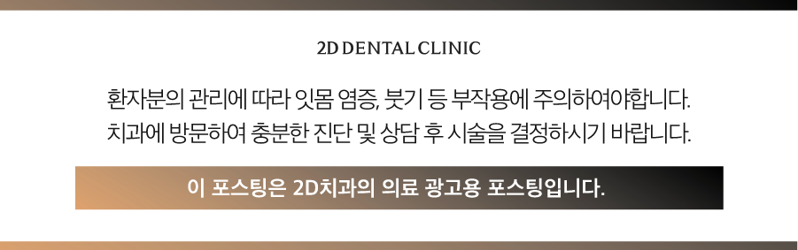 무삭제라미네이트부작용 앞니깨짐 블랙필름으로 걱정 줄이세요! 관련 이미지 12