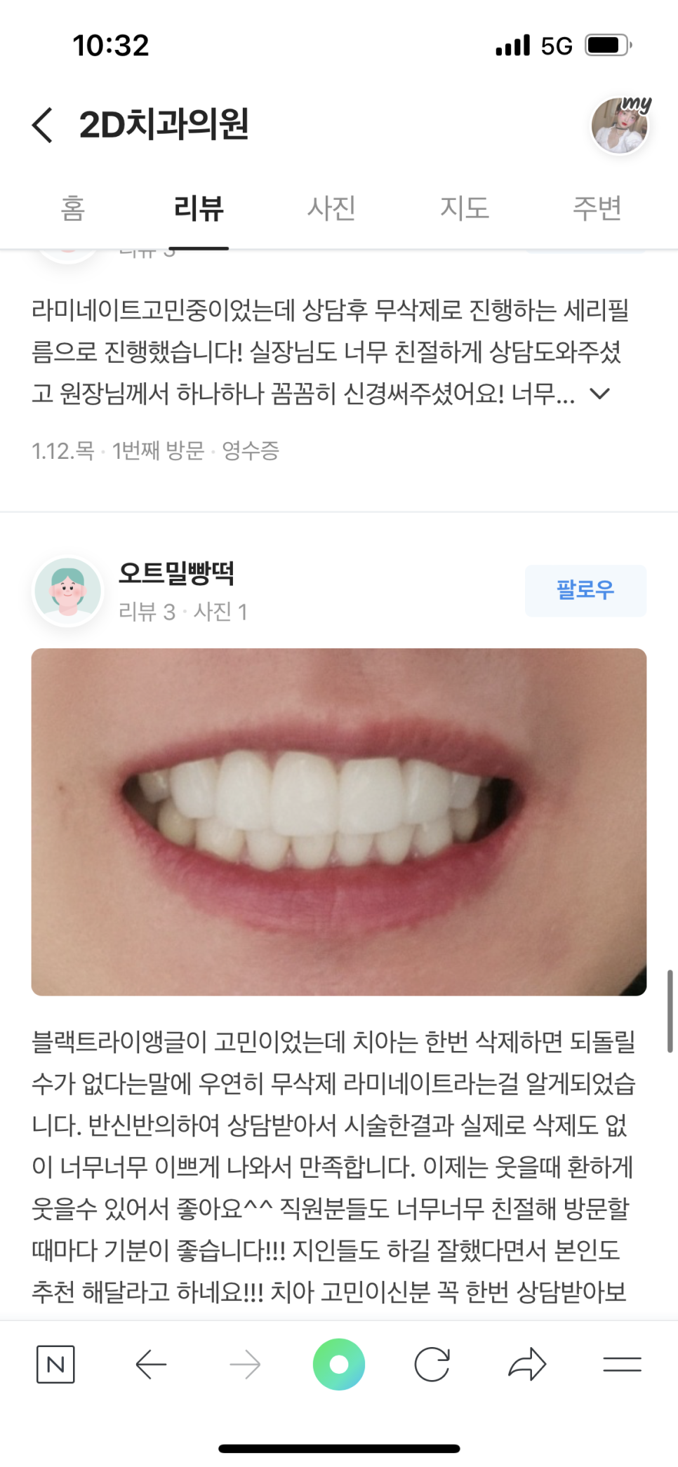 라미네이트치과 :: 투디치과의 토요일 아침 관련 이미지 7