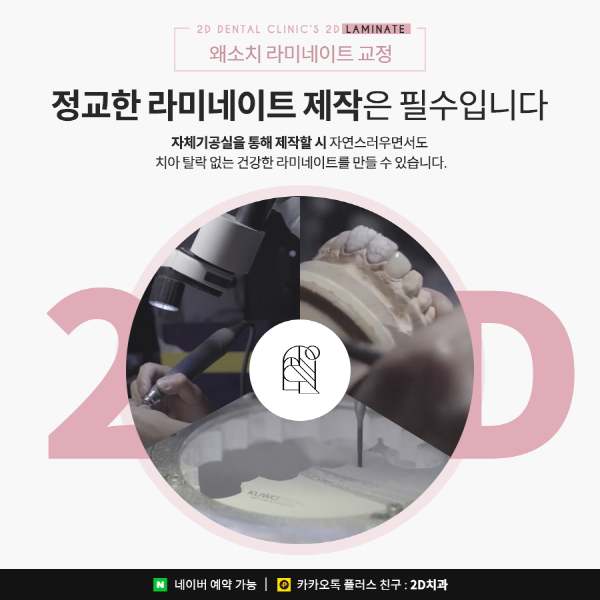 유난히 작은 치아 개선은? 2D 왜소치 라미네이트 교정 관련 이미지 3