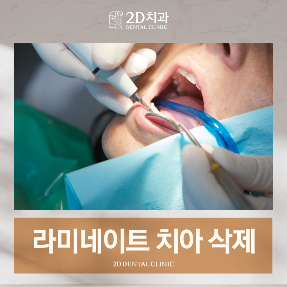 라미네이트치아삭제, 걱정되어 망설이고 계신가요? 관련 이미지 1