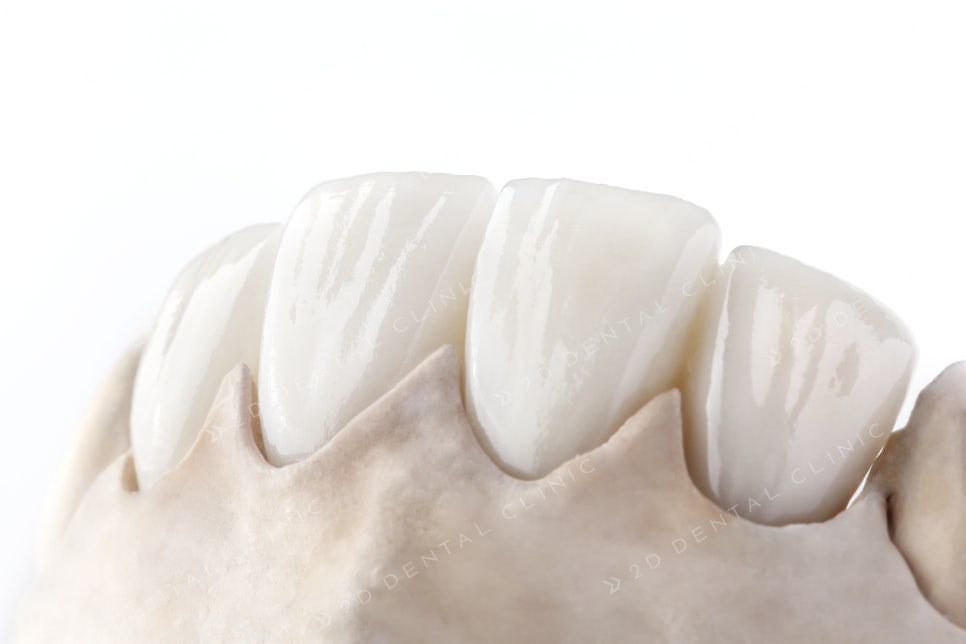 blinx(블링스), 의료의 편의성이 아닌 결과에 초점을 맞추다. 관련 이미지 2