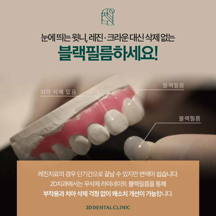 무삭제라미네이트비용 블랙필름 왜소치 고민 해결! 관련 이미지 4