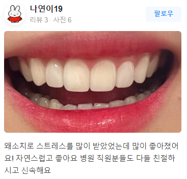 연예인라미네이트 어디가 잘할까? 관련 이미지 10