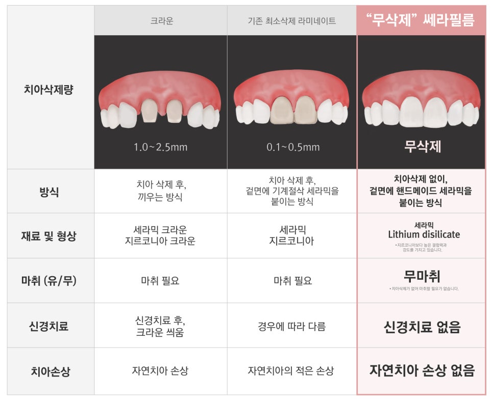 무삭제 쎄라필름의 궁금증 특징?장점? QnA _2D치과(투디치과) 관련 이미지 10