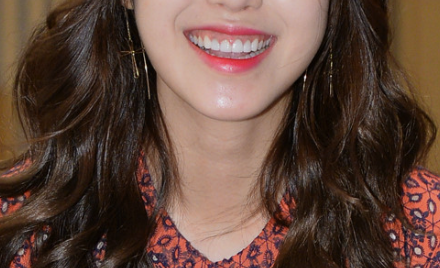 거미스마일 잇몸성형 강남라미네이트 2D치과 관련 이미지 8