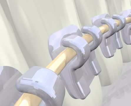 [투디(2D)치과] 2D치과의 2D교정이 특별한 이유! 관련 이미지 5