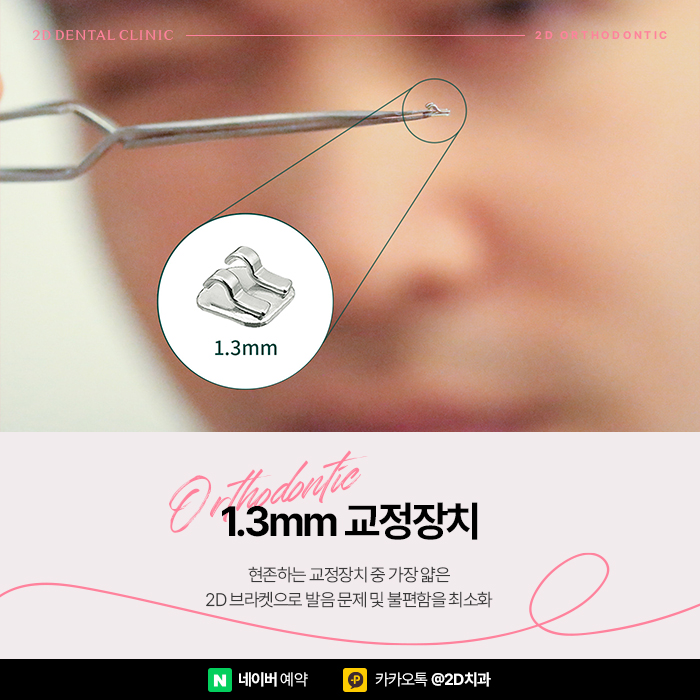 치아교정 통증 줄이는 방법, 부분교정으로 고통 최소화 관련 이미지 7