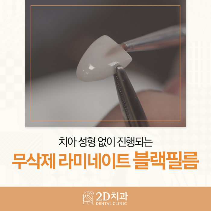 마취 필요 없는 블랙필름 무삭제라미네이트가격, 장점, 특징 관련 이미지 1