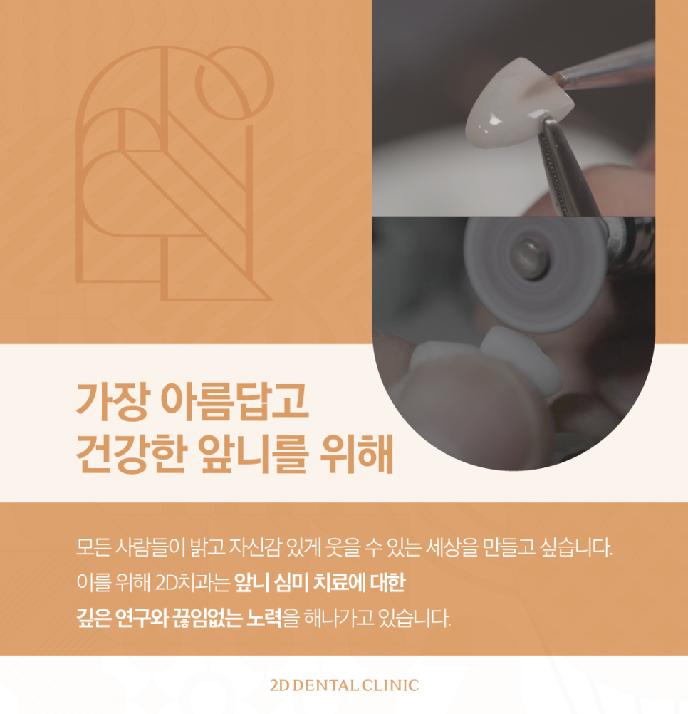 무삭제라미네이트비용 앞니성형 이렇게 결정됩니다 관련 이미지 9