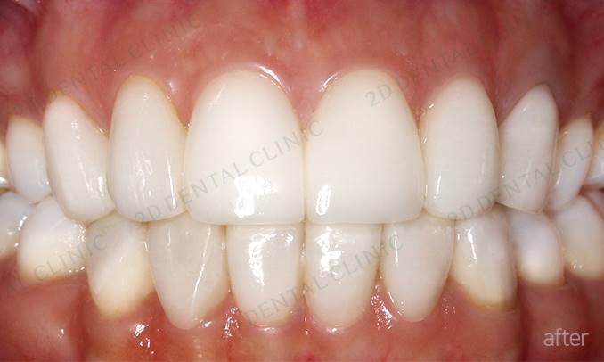 김현진 연애의맛? 또 어디서 봤더라? 관련 이미지 8