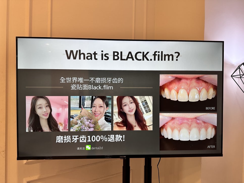무삭제라미네이트가격 관련 이미지 3