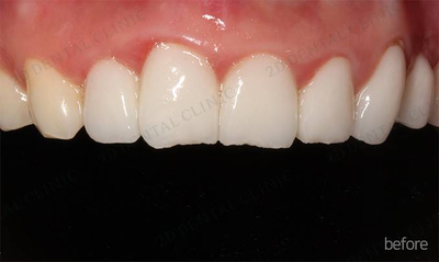 김현진 연애의맛? 또 어디서 봤더라? 관련 이미지 5