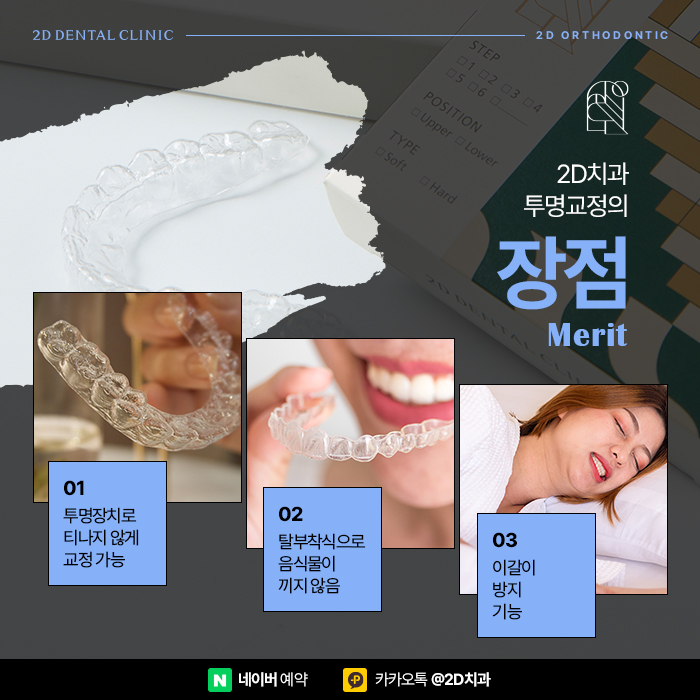 티안나는교정 찾는다면 논현동치과에서 투명교정가격 따져보세요. 관련 이미지 2